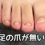 足の爪が伸びない！そんな方はネイルサロンに行こう！