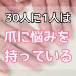 30人に1人は爪に悩みを持っている