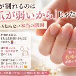爪が割れるのは「爪が弱いから」じゃない？意外と知らない本当の原因